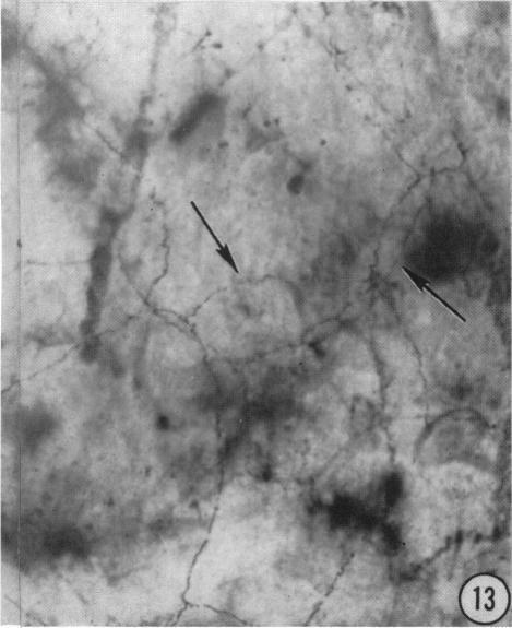 https://cdn.ncbi.nlm.nih.gov/pmc/blobs/90bf/1244097/14e959e7aa2a/janat00433-0131-c.jpg