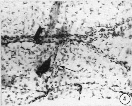 https://cdn.ncbi.nlm.nih.gov/pmc/blobs/90bf/1244097/2662b0534bd3/janat00433-0129-d.jpg