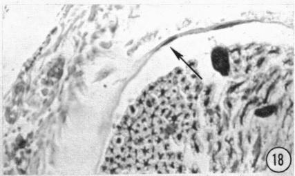 https://cdn.ncbi.nlm.nih.gov/pmc/blobs/90bf/1244097/615d0255987a/janat00433-0132-d.jpg