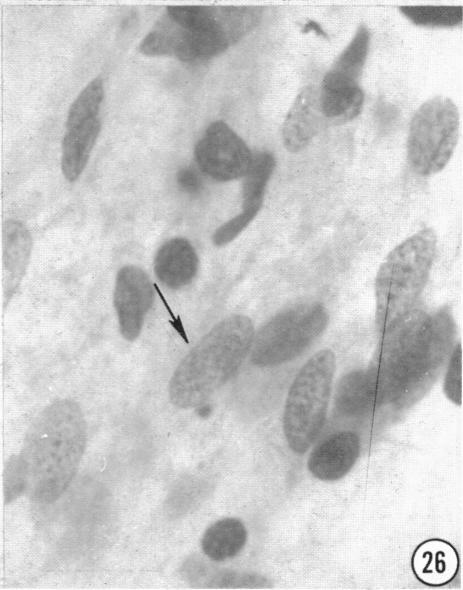 https://cdn.ncbi.nlm.nih.gov/pmc/blobs/90bf/1244097/9758a2bcb796/janat00433-0133-d.jpg
