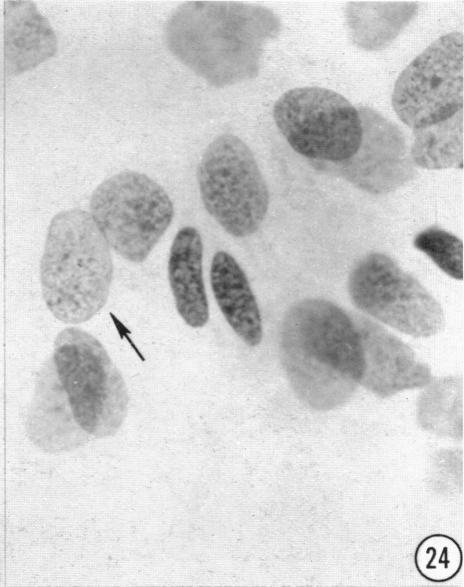https://cdn.ncbi.nlm.nih.gov/pmc/blobs/90bf/1244097/9ca1e10bd450/janat00433-0133-b.jpg