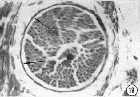 https://cdn.ncbi.nlm.nih.gov/pmc/blobs/90bf/1244097/a54c9051d2fd/janat00433-0132-e.jpg