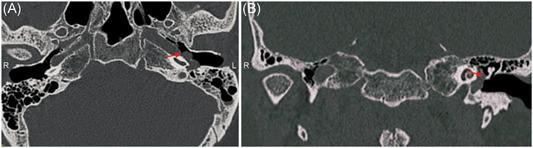 https://cdn.ncbi.nlm.nih.gov/pmc/blobs/90c0/10696267/03251afce5a6/WJO2-9-302-g001.jpg