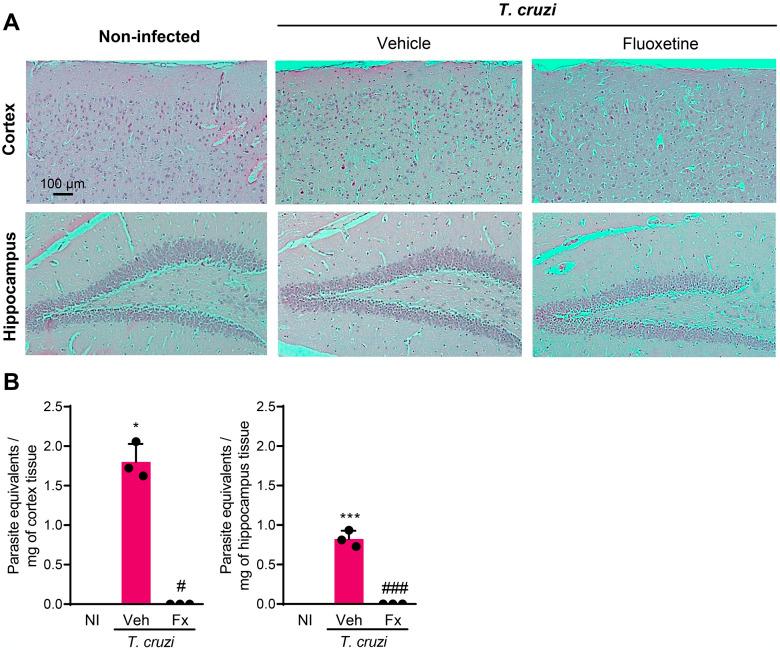 https://cdn.ncbi.nlm.nih.gov/pmc/blobs/90c3/11149870/13ea4c050497/pntd.0012199.g005.jpg
