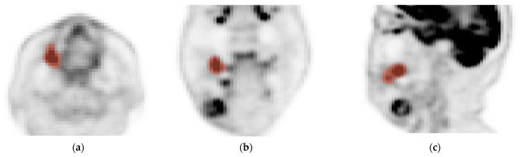 https://cdn.ncbi.nlm.nih.gov/pmc/blobs/90c3/11273837/cb85d48d1831/biomedicines-12-01411-g001.jpg
