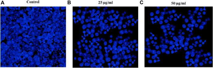 https://cdn.ncbi.nlm.nih.gov/pmc/blobs/90c4/11920177/0fa0ad6640f3/fchem-13-1521089-g009.jpg