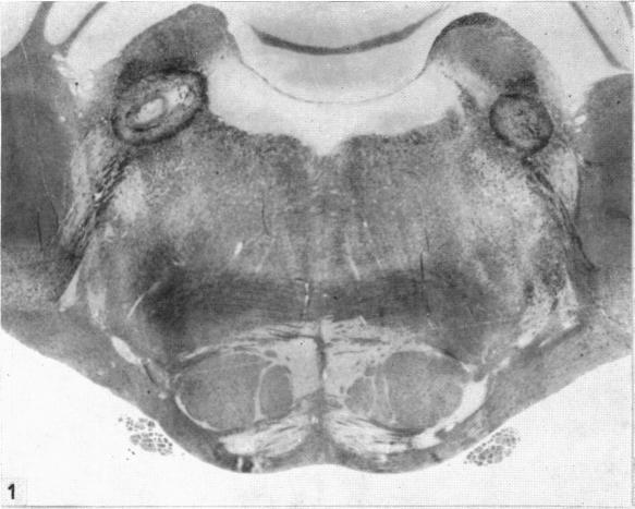 https://cdn.ncbi.nlm.nih.gov/pmc/blobs/90c6/1244888/5925b81117e3/janat00451-0115-a.jpg