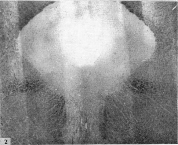 https://cdn.ncbi.nlm.nih.gov/pmc/blobs/90c6/1244888/eb2b937e128b/janat00451-0115-b.jpg