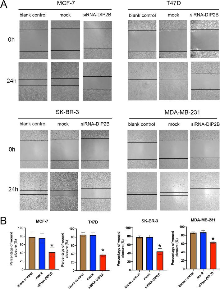 https://cdn.ncbi.nlm.nih.gov/pmc/blobs/90cd/10064539/e5a482fb8972/12885_2023_10751_Fig14_HTML.jpg
