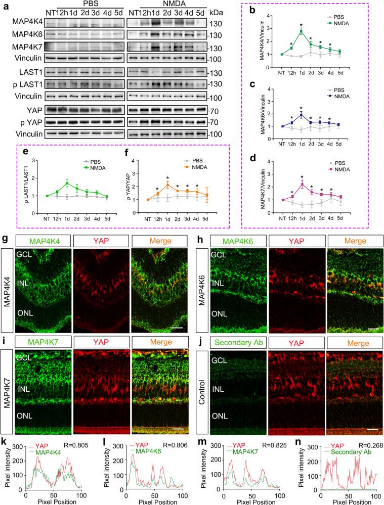 https://cdn.ncbi.nlm.nih.gov/pmc/blobs/90cf/10344969/29171beeb5ae/41536_2023_310_Fig1_HTML.jpg