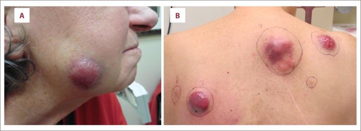 https://cdn.ncbi.nlm.nih.gov/pmc/blobs/90d1/5952731/38a62a01860b/amjcaserep-19-505-g001.jpg