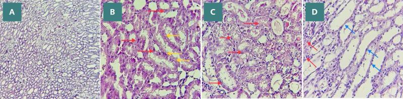 https://cdn.ncbi.nlm.nih.gov/pmc/blobs/90df/10994612/8a0cfdc7a75d/JMedLife-16-1852-g008.jpg