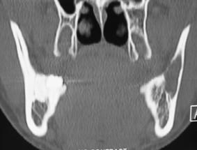 https://cdn.ncbi.nlm.nih.gov/pmc/blobs/90e0/1660580/9fc7416cc36d/1746-160X-2-40-3.jpg