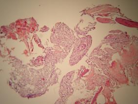 https://cdn.ncbi.nlm.nih.gov/pmc/blobs/90e0/1660580/b60a9ea2f1da/1746-160X-2-40-5.jpg