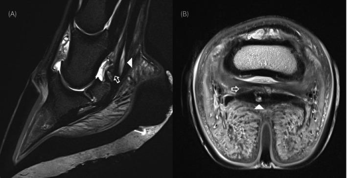 https://cdn.ncbi.nlm.nih.gov/pmc/blobs/90e3/12326952/deed94d058b7/EVJ-57-1183-g001.jpg