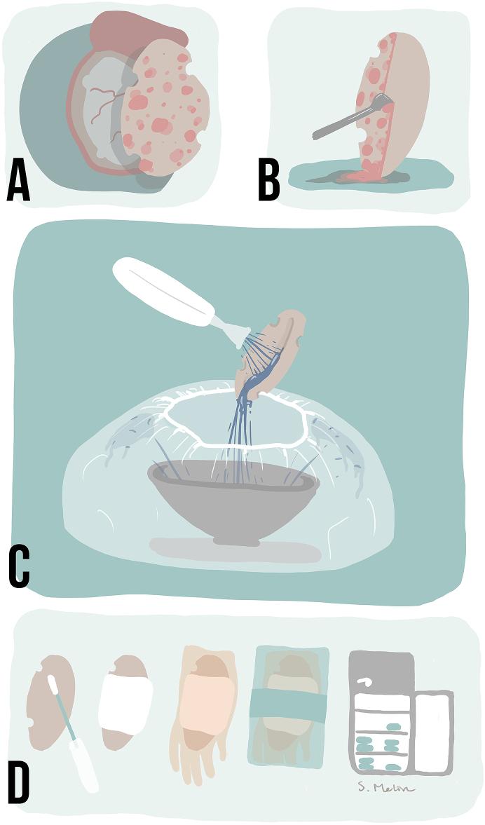 https://cdn.ncbi.nlm.nih.gov/pmc/blobs/90e6/9560573/c15ff3454499/gr2.jpg