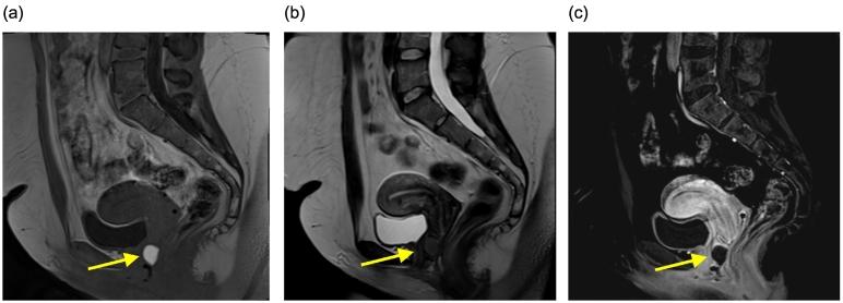 https://cdn.ncbi.nlm.nih.gov/pmc/blobs/90ef/7287488/ca67ee2ee932/gr1.jpg