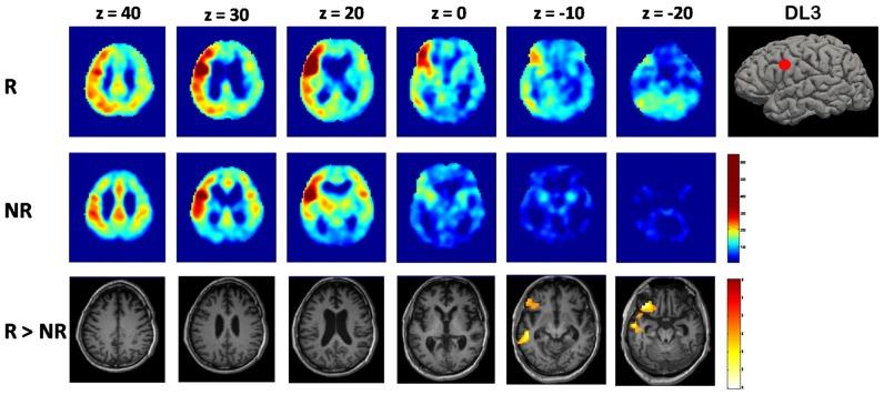 https://cdn.ncbi.nlm.nih.gov/pmc/blobs/90f2/5093112/452baebced2a/fncel-10-00257-g0002.jpg