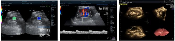 https://cdn.ncbi.nlm.nih.gov/pmc/blobs/90f4/11992222/8778afb7b0b8/41598_2025_97151_Fig3_HTML.jpg