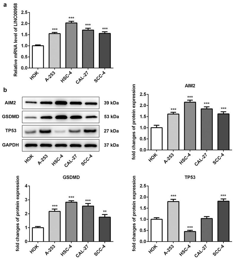 https://cdn.ncbi.nlm.nih.gov/pmc/blobs/90f4/8806533/ed836fdcb3bd/KBIE_A_1955561_F0001_B.jpg