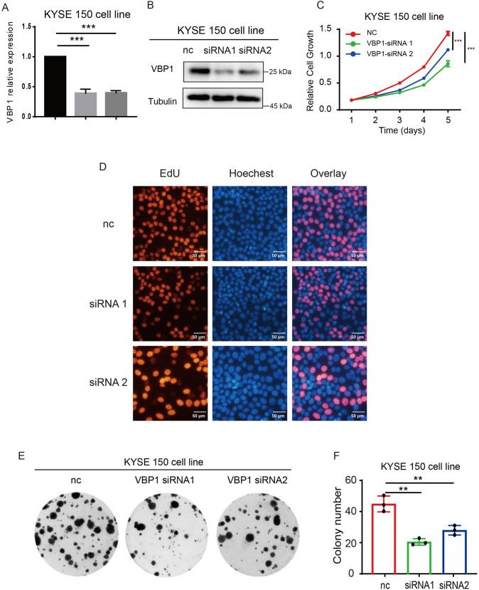 https://cdn.ncbi.nlm.nih.gov/pmc/blobs/90fb/11194215/aa2e31ee2137/13577_2024_1068_Fig7_HTML.jpg