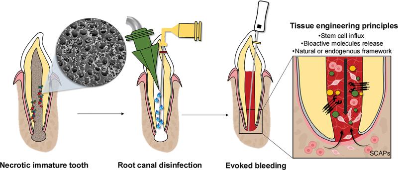 https://cdn.ncbi.nlm.nih.gov/pmc/blobs/90fc/12408052/c204634cfae4/IRME_A_2546759_F0001_OC.jpg