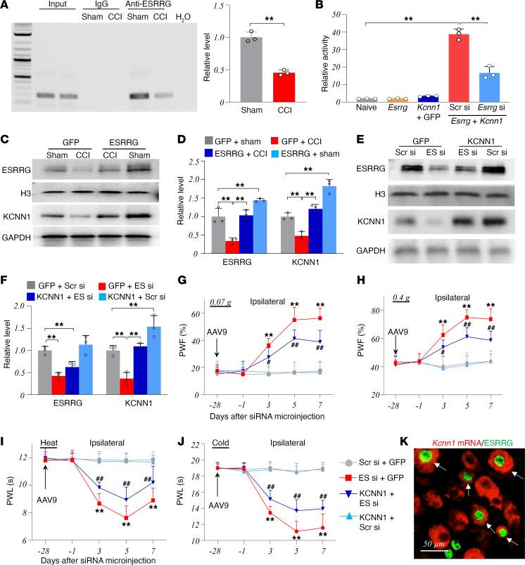 https://cdn.ncbi.nlm.nih.gov/pmc/blobs/9104/11383585/006e1fbc7edc/jciinsight-9-180085-g087.jpg