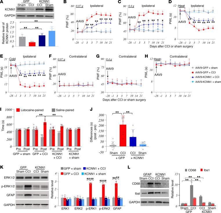 https://cdn.ncbi.nlm.nih.gov/pmc/blobs/9104/11383585/630a359f8143/jciinsight-9-180085-g083.jpg