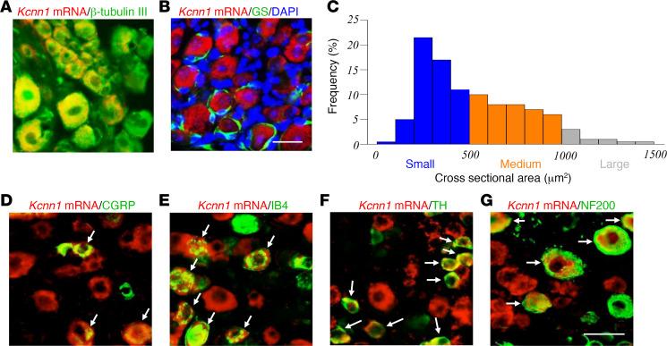 https://cdn.ncbi.nlm.nih.gov/pmc/blobs/9104/11383585/a75013ce4084/jciinsight-9-180085-g081.jpg