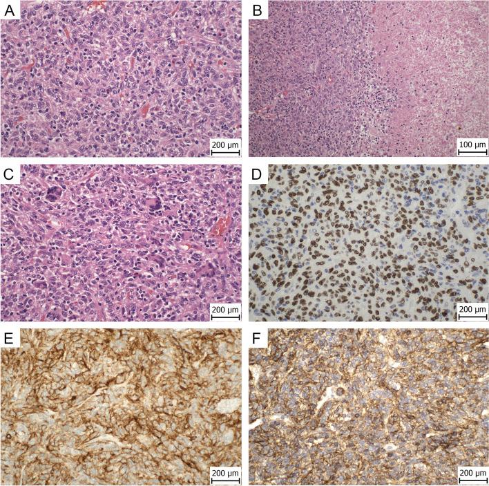 https://cdn.ncbi.nlm.nih.gov/pmc/blobs/9105/9881279/e6e4517aba6a/13000_2023_1304_Fig1_HTML.jpg