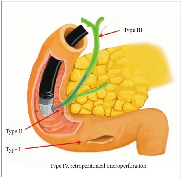 https://cdn.ncbi.nlm.nih.gov/pmc/blobs/9106/3797938/2a932085c54e/ce-46-522-g001.jpg