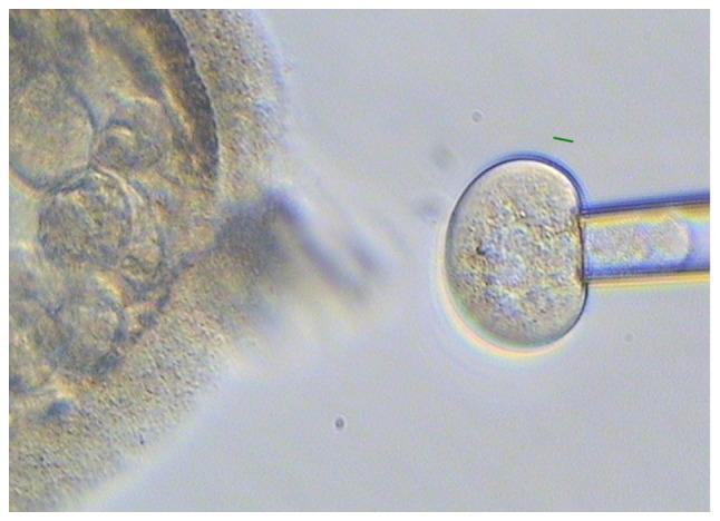 https://cdn.ncbi.nlm.nih.gov/pmc/blobs/9109/9257975/f717459d4f21/etm-24-02-11457-g03.jpg