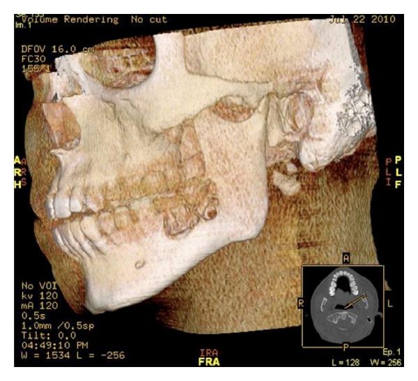https://cdn.ncbi.nlm.nih.gov/pmc/blobs/910d/3509788/ab16e183c9b3/CRIM2012-574316.001.jpg