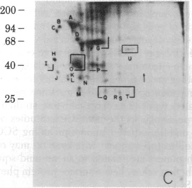 https://cdn.ncbi.nlm.nih.gov/pmc/blobs/910f/346733/45b3f252bbf4/pnas00454-0129-d.jpg