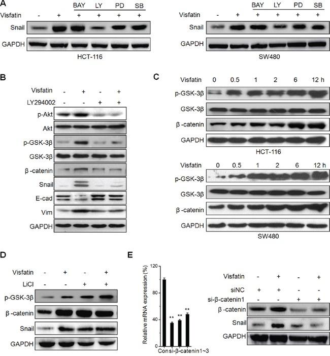 https://cdn.ncbi.nlm.nih.gov/pmc/blobs/9116/5078014/a1ad20770b17/oncotarget-07-32306-g004.jpg