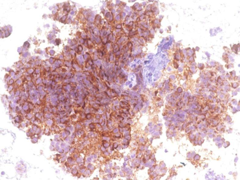 https://cdn.ncbi.nlm.nih.gov/pmc/blobs/9117/9019676/3671ee24ffd5/RJME-62-3-723-fig5.jpg