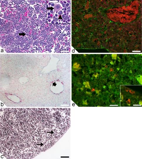 https://cdn.ncbi.nlm.nih.gov/pmc/blobs/911a/3102842/851b7078832c/441_2011_1170_Fig5_HTML.jpg