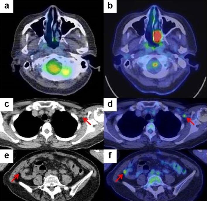 https://cdn.ncbi.nlm.nih.gov/pmc/blobs/9120/6885028/a3a978a39935/12328_2019_996_Fig8_HTML.jpg