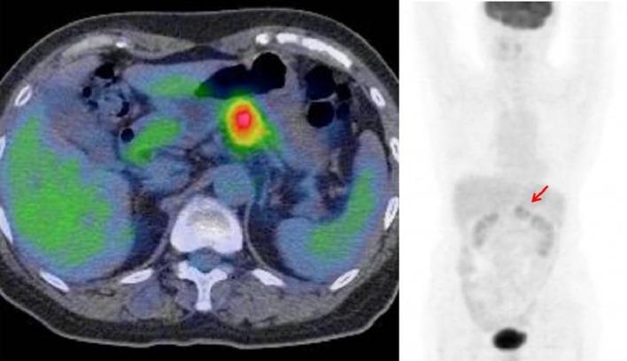 https://cdn.ncbi.nlm.nih.gov/pmc/blobs/9120/6885028/cb1e108ef757/12328_2019_996_Fig5_HTML.jpg