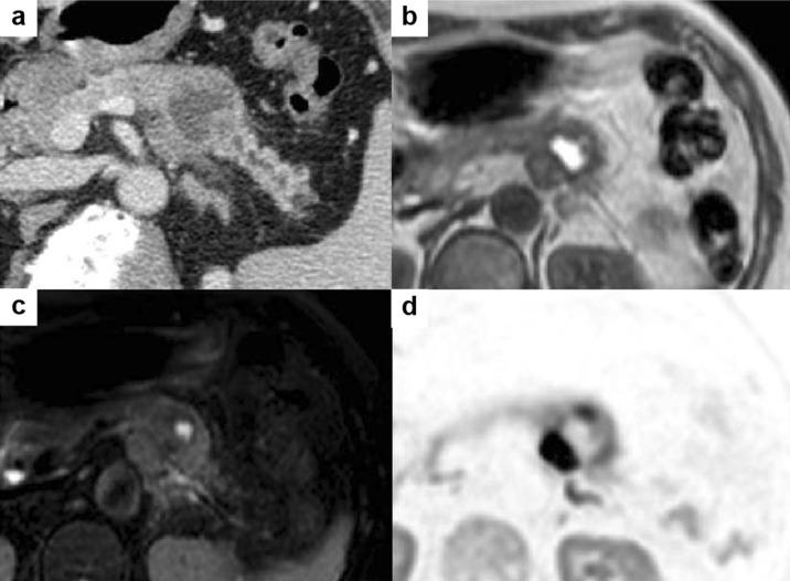 https://cdn.ncbi.nlm.nih.gov/pmc/blobs/9120/6885028/e8b7c575d9e9/12328_2019_996_Fig1_HTML.jpg