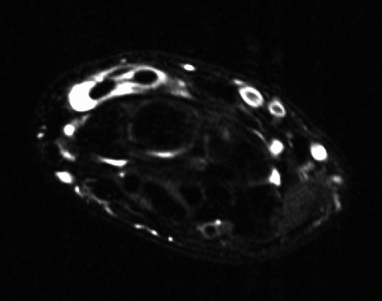 https://cdn.ncbi.nlm.nih.gov/pmc/blobs/9122/10148692/7381f982ae08/cureus-0015-00000036919-i01.jpg