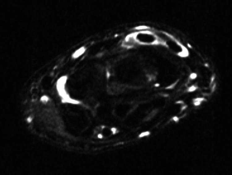 https://cdn.ncbi.nlm.nih.gov/pmc/blobs/9122/10148692/c6a6007c8d69/cureus-0015-00000036919-i02.jpg