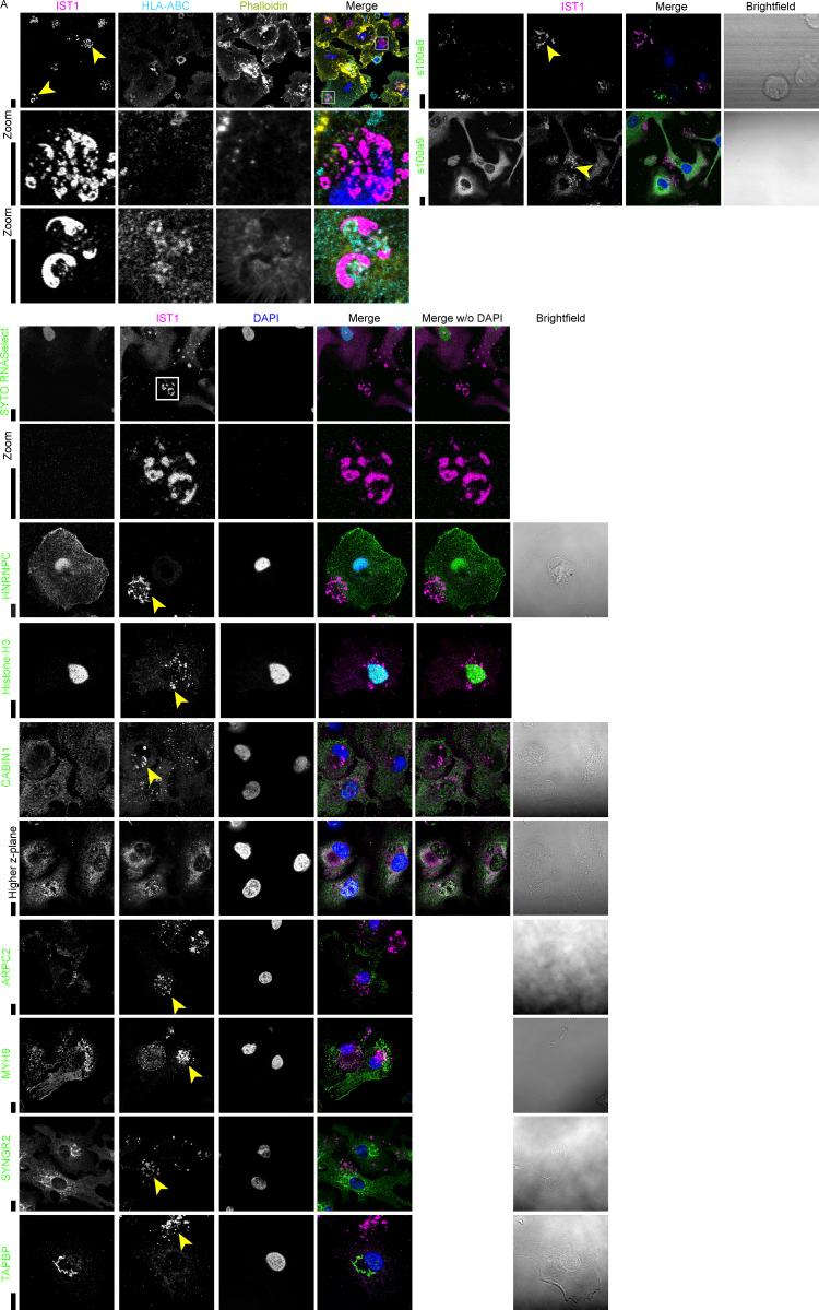 https://cdn.ncbi.nlm.nih.gov/pmc/blobs/9123/10200693/32ccb0dd68ff/JCB_202205130_FigS6.jpg