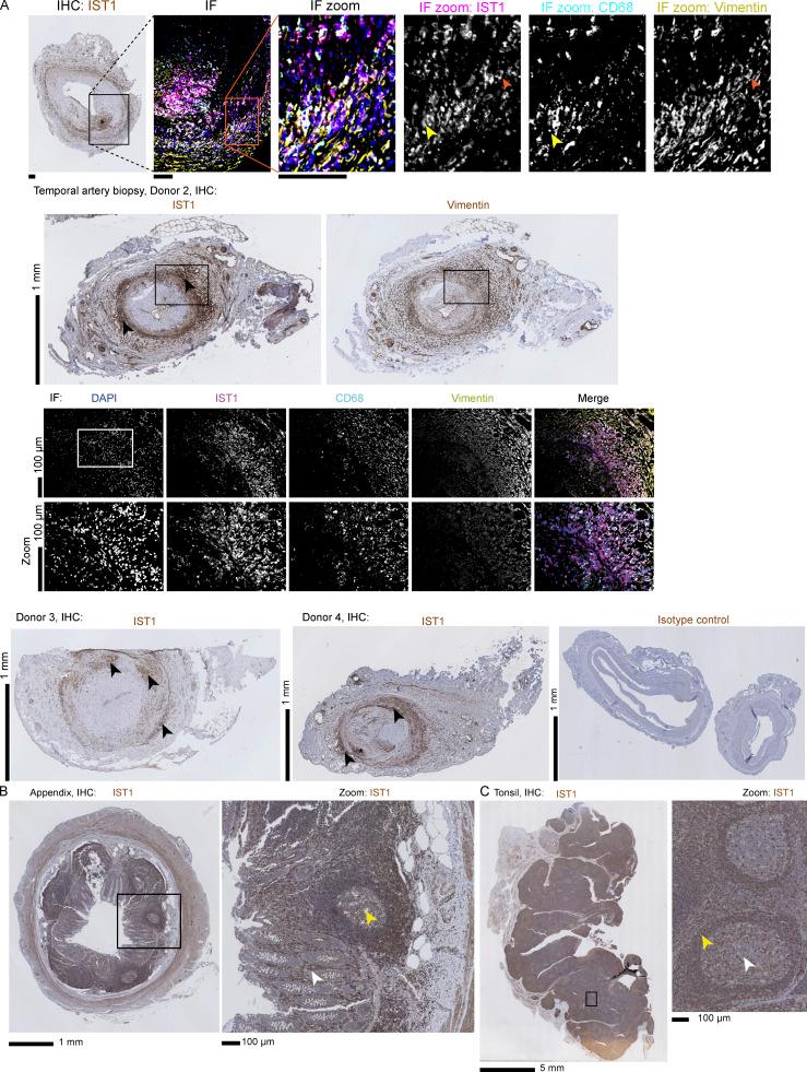 https://cdn.ncbi.nlm.nih.gov/pmc/blobs/9123/10200693/518120e5122f/JCB_202205130_Fig5.jpg