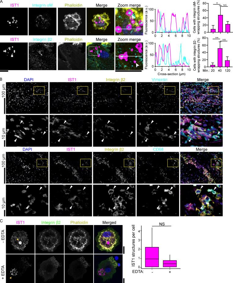 https://cdn.ncbi.nlm.nih.gov/pmc/blobs/9123/10200693/8e31382179ed/JCB_202205130_Fig8.jpg
