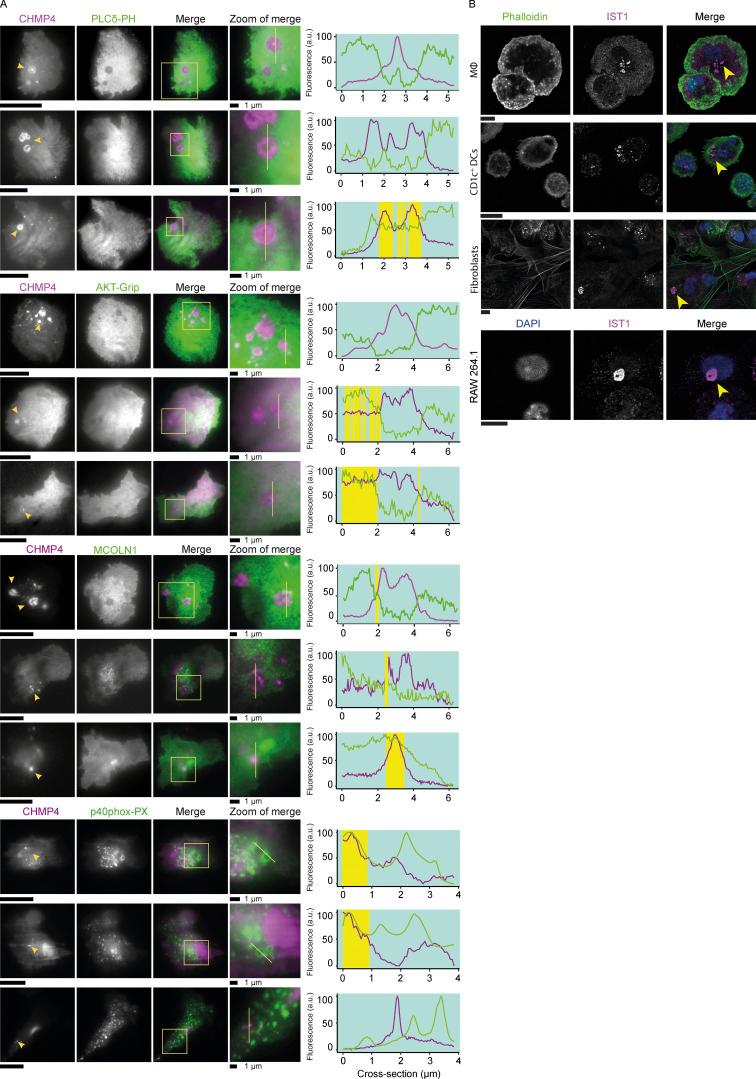 https://cdn.ncbi.nlm.nih.gov/pmc/blobs/9123/10200693/d29a63ea2748/JCB_202205130_Fig4.jpg