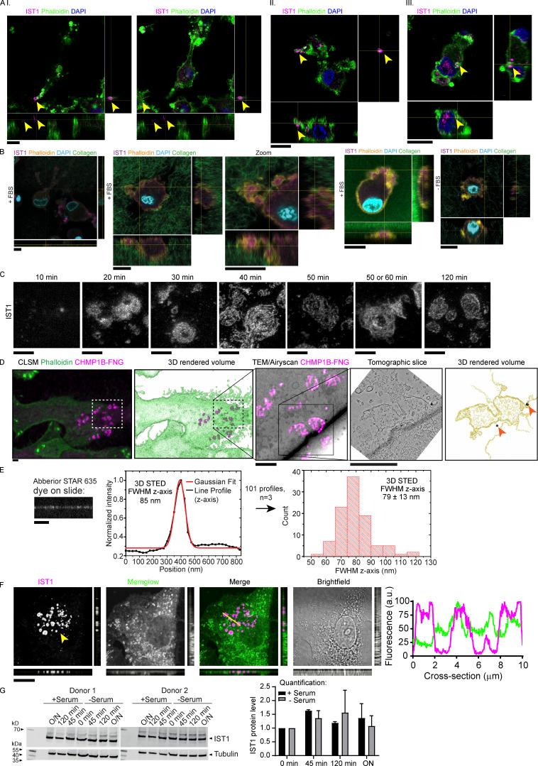 https://cdn.ncbi.nlm.nih.gov/pmc/blobs/9123/10200693/dc252d2a7a2d/JCB_202205130_FigS1.jpg