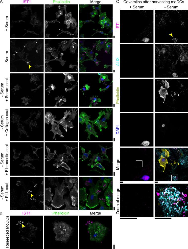 https://cdn.ncbi.nlm.nih.gov/pmc/blobs/9123/10200693/f87191846747/JCB_202205130_Fig7.jpg