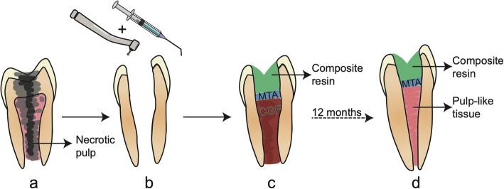 https://cdn.ncbi.nlm.nih.gov/pmc/blobs/912a/8214771/8e108e3fda4a/13287_2021_2446_Fig3_HTML.jpg
