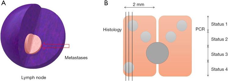 https://cdn.ncbi.nlm.nih.gov/pmc/blobs/912c/9638790/6c460e6ef803/gs-11-10-1628-f1.jpg